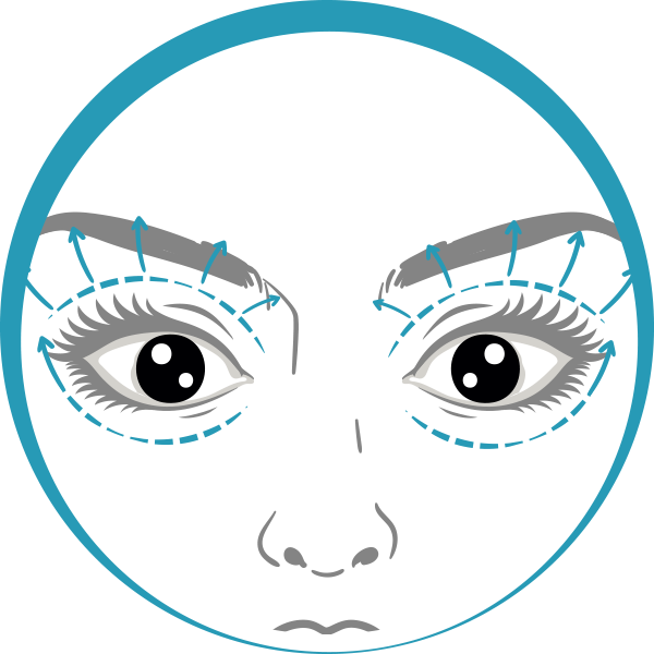 Quiero cotizar una Blefaroplastía