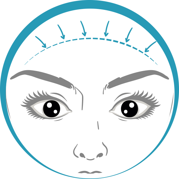 Quiero cotizar una Frontoplastía