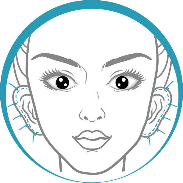 Quiero cotizar una Otoplastía