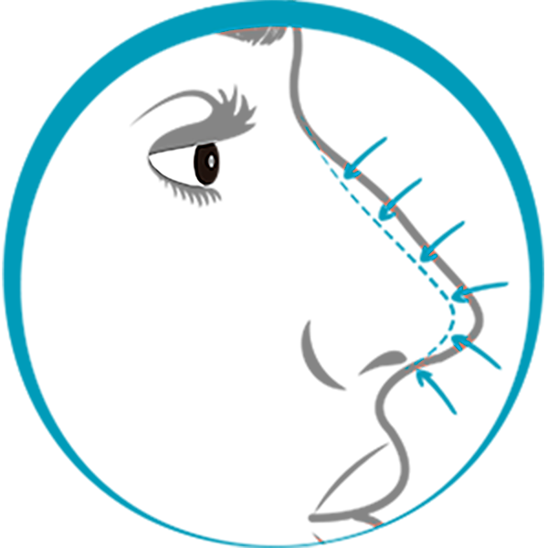 Quiero cotizar una Rinoplastía